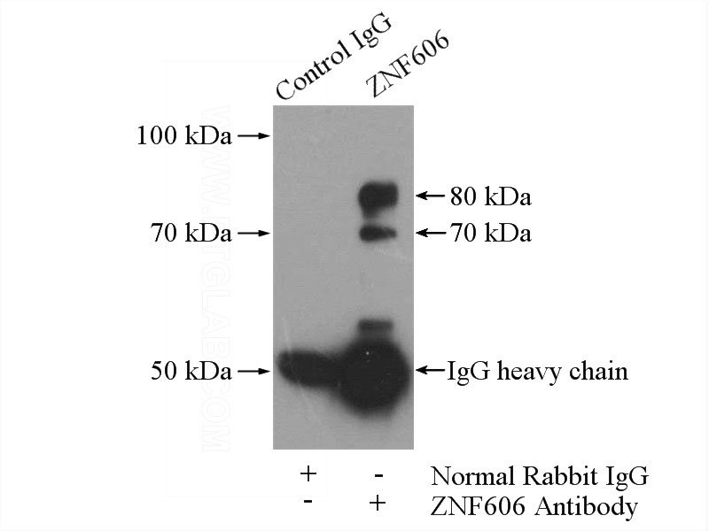 IP Result of anti-ZNF606 (IP:Catalog No:117011, 4ug; Detection:Catalog No:117011 1:300) with mouse liver tissue lysate 4000ug.