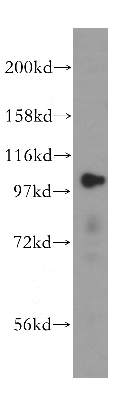 HeLa cells were subjected to SDS PAGE followed by western blot with Catalog No:112295(LONP1 antibody) at dilution of 1:500