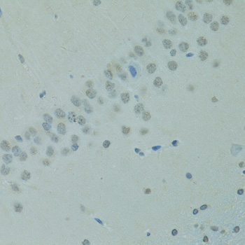 Immunohistochemistry - CTAG1B Polyclonal Antibody 