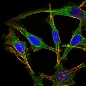 Immunofluorescence analysis of Hela cells using PRL mouse mAb (green). Blue