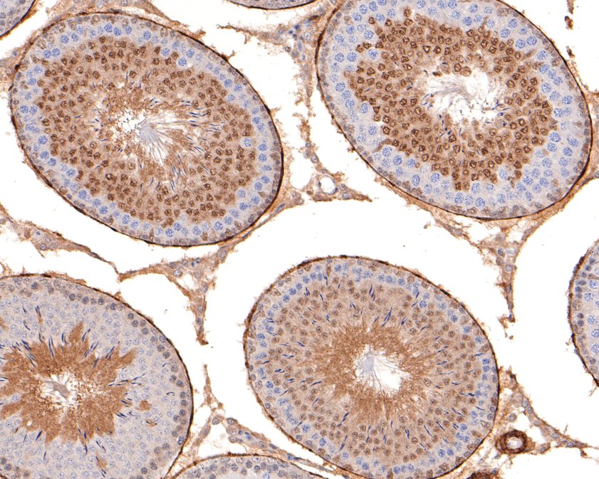 Fig6:; Immunohistochemical analysis of paraffin-embedded rat testis tissue using anti-USP11 antibody. The section was pre-treated using heat mediated antigen retrieval with sodium citrate buffer (pH 6.0) for 20 minutes. The tissues were blocked in 1% BSA for 30 minutes at room temperature, washed with ddH; 2; O and PBS, and then probed with the primary antibody ( 1/400) for 30 minutes at room temperature. The detection was performed using an HRP conjugated compact polymer system. DAB was used as the chromogen. Tissues were counterstained with hematoxylin and mounted with DPX.
