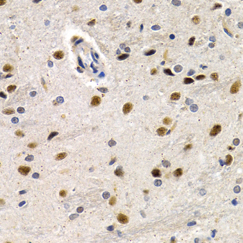 Immunohistochemistry - ID3 Polyclonal Antibody 