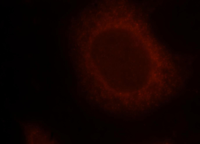 Immunofluorescent analysis of Hela cells, using TNIP1 antibody Catalog No:116144 at 1:25 dilution and Rhodamine-labeled goat anti-rabbit IgG (red).