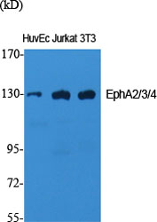 Fig1:; Western Blot analysis of various cells using EphA2/3/4 Polyclonal Antibody