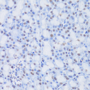 Immunohistochemistry - CBX8 Polyclonal Antibody 