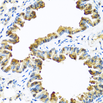 Immunohistochemistry - SERPINA10 Polyclonal Antibody 