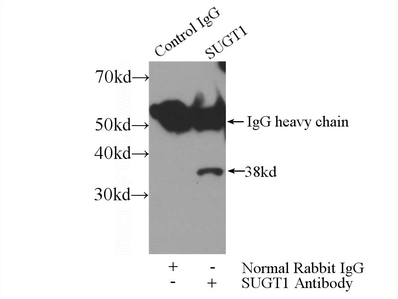IP Result of anti-SUGT1 (IP:Catalog No:115823, 3ug; Detection:Catalog No:115823 1:500) with HEK-293 cells lysate 3200ug.