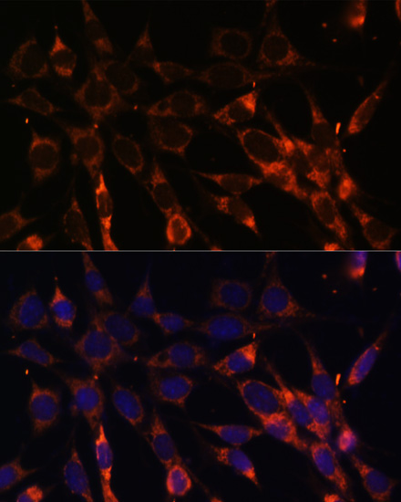Immunofluorescence - SMAD6 Polyclonal Antibody 