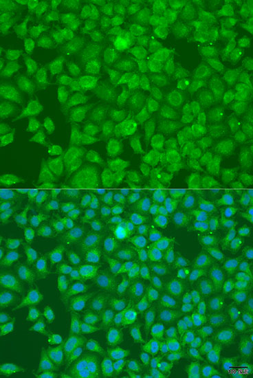 Immunofluorescence - SLC25A6 Polyclonal Antibody 