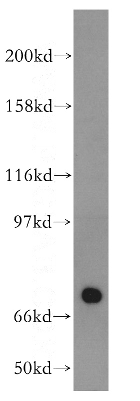 mouse testis tissue were subjected to SDS PAGE followed by western blot with Catalog No:113475(PABPC3 antibody) at dilution of 1:300