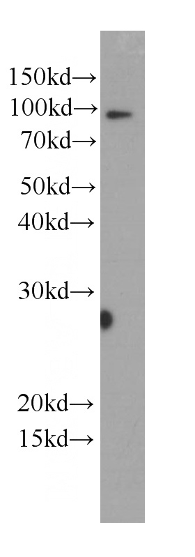 HL-60 cells were subjected to SDS PAGE followed by western blot with Catalog No:107429(MPO Antibody) at dilution of 1:1000