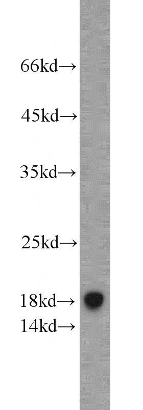 HeLa cells were subjected to SDS PAGE followed by western blot with Catalog No:115901(TCEB2 antibody) at dilution of 1:1000