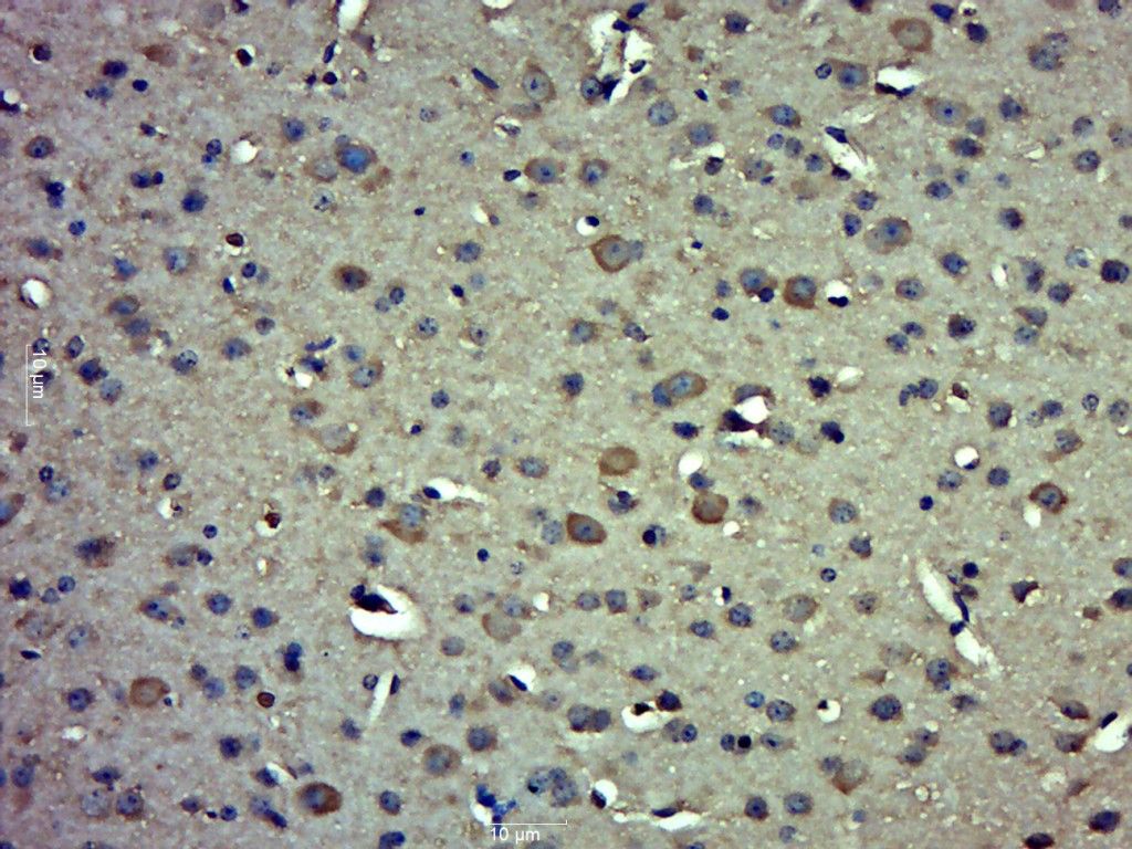Fig3: Paraformaldehyde-fixed, paraffin embedded (Mouse brain); Antigen retrieval by boiling in sodium citrate buffer (pH6.0) for 15min; Block endogenous peroxidase by 3% hydrogen peroxide for 20 minutes; Blocking buffer (normal goat serum) at 37℃ for 30min; Antibody incubation with (IMPACT) Polyclonal Antibody, Unconjugated at 1:500 overnight at 4℃, followed by a conjugated secondary (sp-0023) for 20 minutes and DAB staining.
