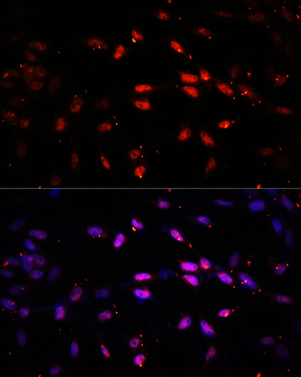 Immunofluorescence - Kdm6b Polyclonal Antibody 