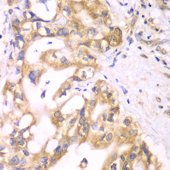 Immunohistochemistry - ACADS Polyclonal Antibody 