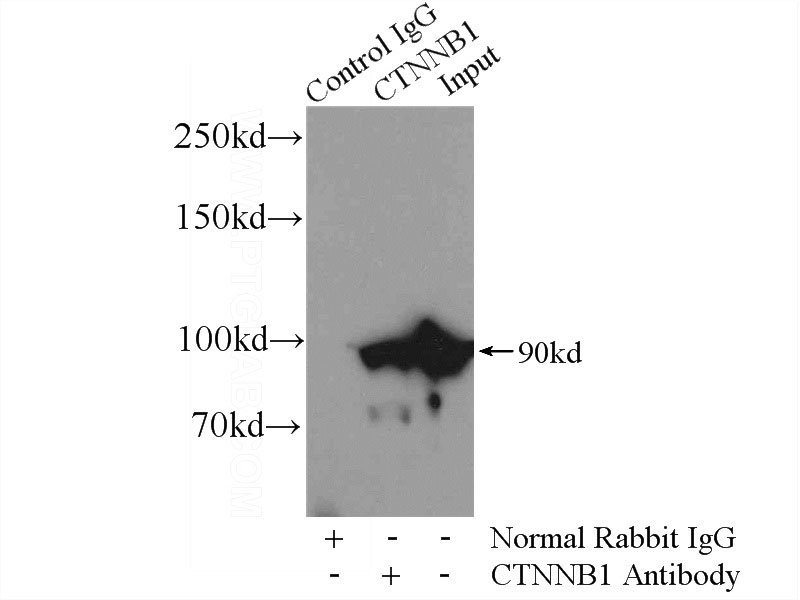 IP Result of anti-B-catenin (IP:Catalog No:117132, 4ug; Detection:Catalog No:117132 1:500) with mouse liver tissue lysate 6400ug.