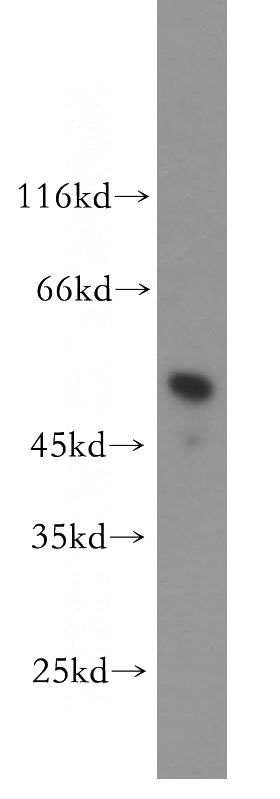 mouse spleen tissue were subjected to SDS PAGE followed by western blot with Catalog No:111841(IRF8 antibody) at dilution of 1:300