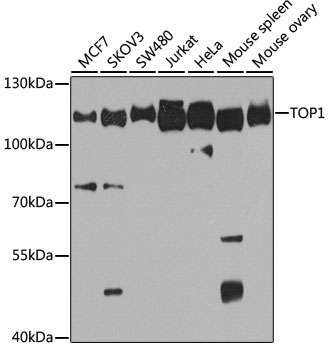Western blot - TOP1 Polyclonal Antibody 