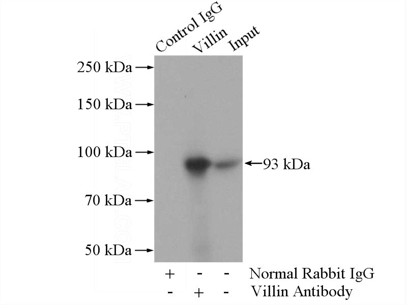 IP Result of anti-VIL1 (IP:Catalog No:116752, 4ug; Detection:Catalog No:116752 1:300) with mouse kidney tissue lysate 4000ug.