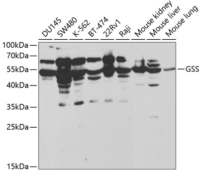 Western blot - GSS Polyclonal Antibody 