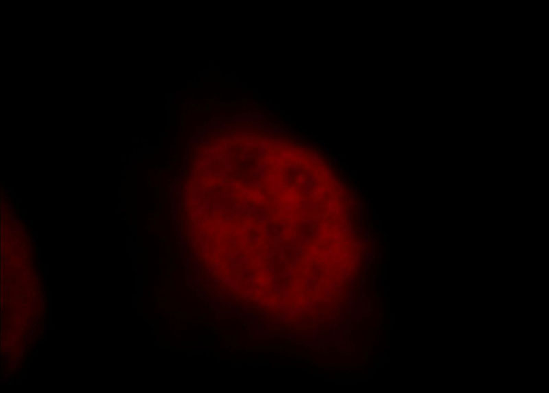 Immunofluorescent analysis of Hela cells, using CTR9 antibody Catalog No:109730 at 1:25 dilution and Rhodamine-labeled goat anti-rabbit IgG (red).