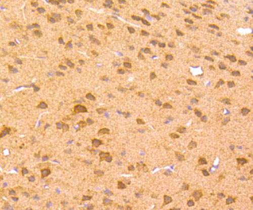 Fig2: Immunohistochemical analysis of paraffin-embedded mouse brain tissue using anti-Zic1 antibody. Counter stained with hematoxylin.