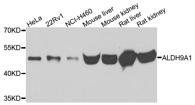 Western blot - ALDH9A1 Polyclonal Antibody 