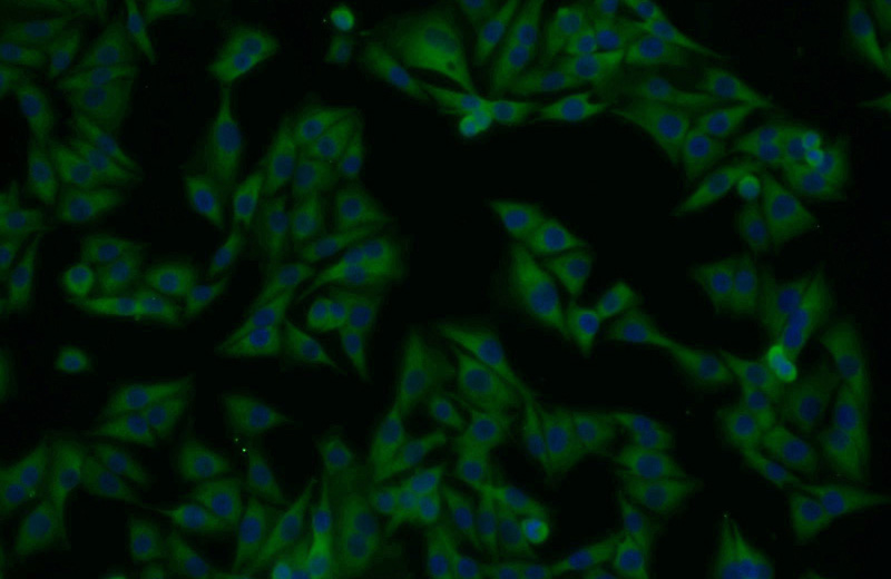 Immunofluorescent analysis of A375 cells using Catalog No:110363(ERK1/2 Antibody) at dilution of 1:25 and Alexa Fluor 488-congugated AffiniPure Goat Anti-Rabbit IgG(H+L)