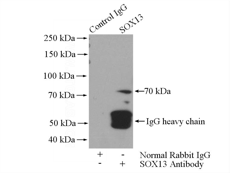 IP Result of anti-SOX13 (IP:Catalog No:115511, 4ug; Detection:Catalog No:115511 1:500) with SH-SY5Y cells lysate 1200ug.