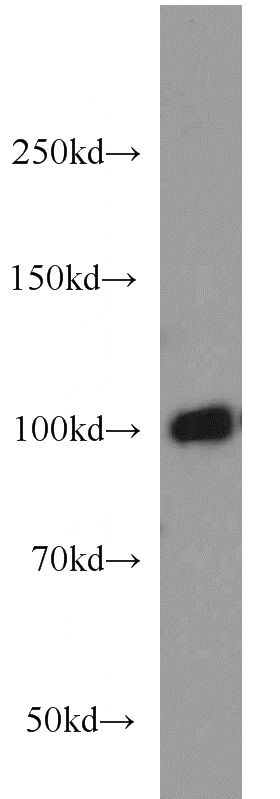 HEK-293 cells were subjected to SDS PAGE followed by western blot with Catalog No:109423(CNGA3 antibody) at dilution of 1:600