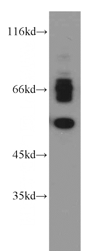 Jurkat cells were subjected to SDS PAGE followed by western blot with Catalog No:116763(VMAT2 antibody) at dilution of 1:300