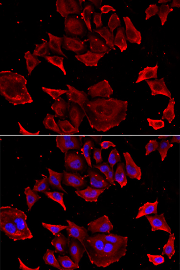 Immunofluorescence - TCAP Polyclonal Antibody 
