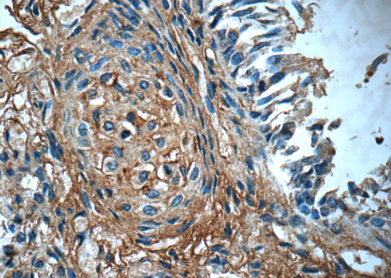 Immunohistochemistry of paraffin-embedded human lung tissue slide using Catalog No:114257(PTAFR Antibody) at dilution of 1:50 (under 40x lens)