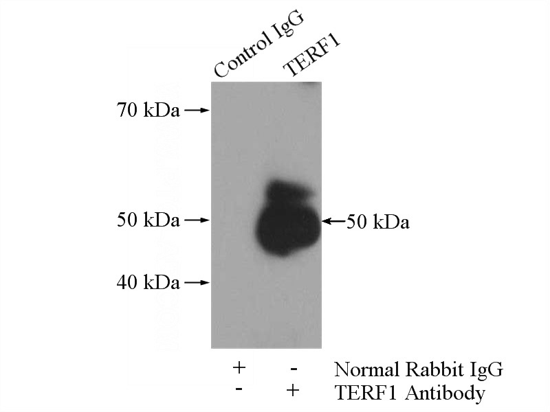 IP Result of anti-TERF1 (IP:Catalog No:115946, 4ug; Detection:Catalog No:115946 1:300) with HEK-293 cells lysate 2000ug.