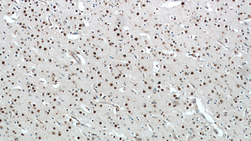 Immunohistochemical of paraffin-embedded human brain using Catalog No:115881(TBR1 antibody) at dilution of 1:100 (under 10x lens)