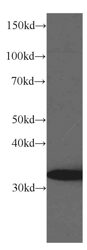 rat brain tissue were subjected to SDS PAGE followed by western blot with Catalog No:107648(TST Antibody) at dilution of 1:1000