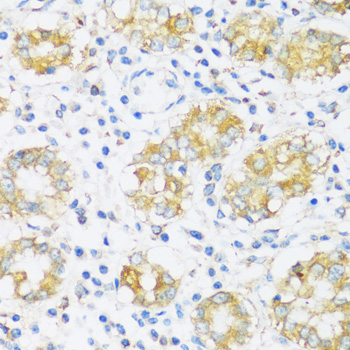 Immunohistochemistry - BRSK1 Polyclonal Antibody 
