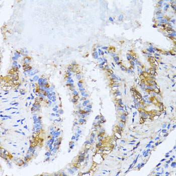 Immunohistochemistry - NAT2 Polyclonal Antibody 