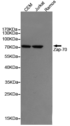 Western blot detection of ZAP-70 in CEM and Jurkat cell lysates,negative in the Ramos cell lysates using ZAP-70 mouse mAb (1:1000 diluted).Predicted band size:70KDa.Observed band size:70KDa.