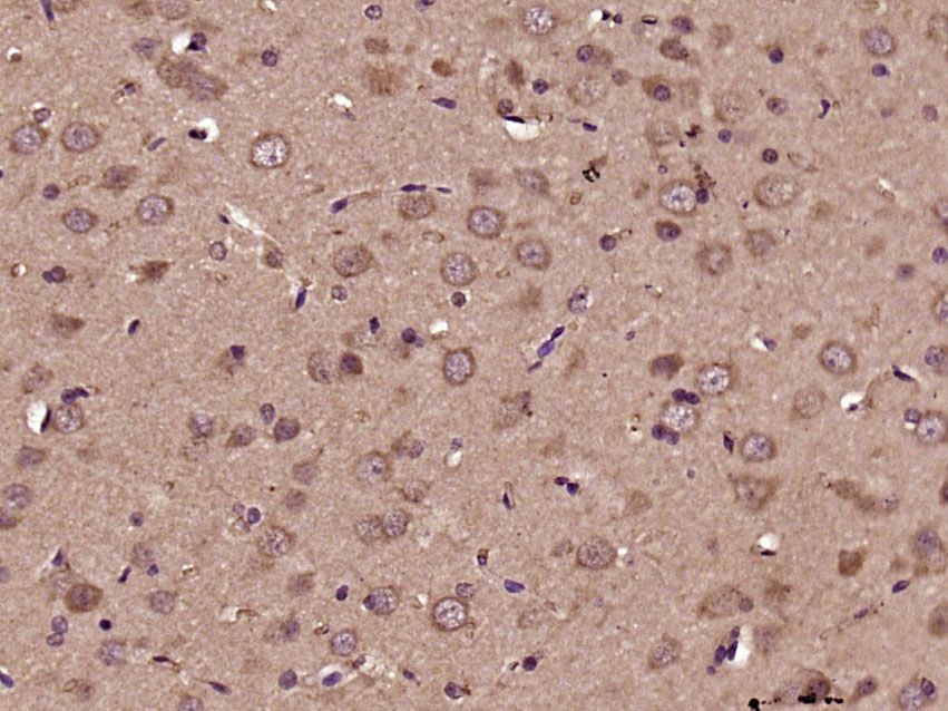 Fig2: Paraformaldehyde-fixed, paraffin embedded (Rat brain); Antigen retrieval by boiling in sodium citrate buffer (pH6.0) for 15min; Block endogenous peroxidase by 3% hydrogen peroxide for 20 minutes; Blocking buffer (normal goat serum) at 37℃ for 30min; Antibody incubation with (DGKI) Polyclonal Antibody, Unconjugated at 1:500 overnight at 4℃, followed by a conjugated secondary (sp-0023) for 20 minutes and DAB staining.