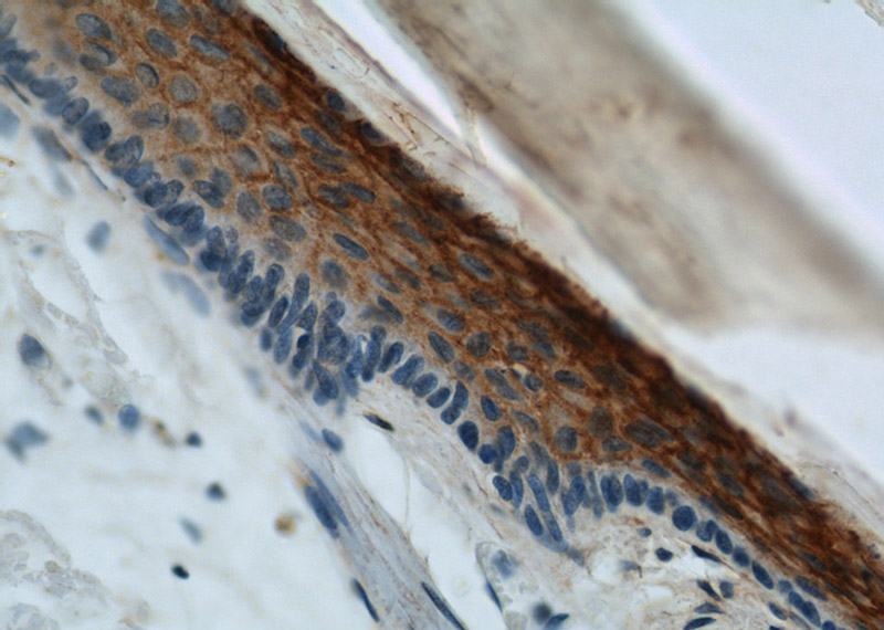 Immunohistochemical of paraffin-embedded human skin using Catalog No:109336(CLDN1 antibody) at dilution of 1:50 (under 40x lens)