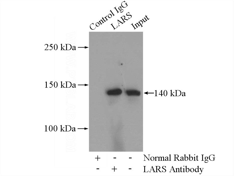 IP Result of anti-LARS (IP:Catalog No:112149, 4ug; Detection:Catalog No:112149 1:500) with Jurkat cells lysate 2400ug.