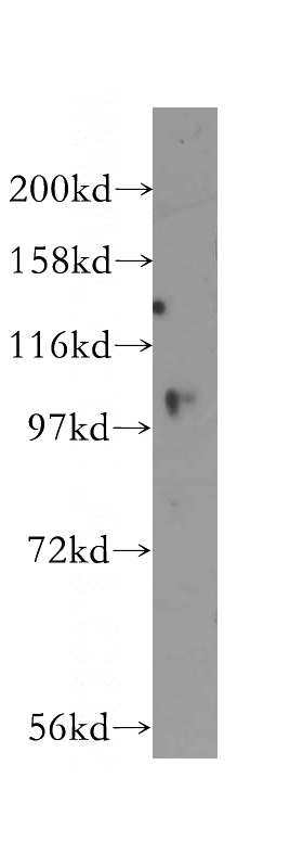 HEK-293 cells were subjected to SDS PAGE followed by western blot with Catalog No:116606(USP33 antibody) at dilution of 1:400