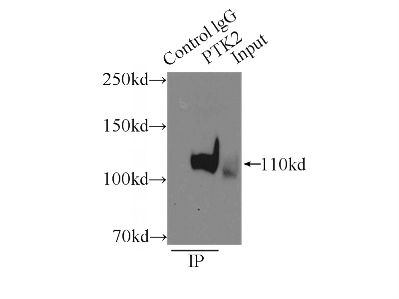 IP Result of anti-FAK (IP:Catalog No:110455, 3ug; Detection:Catalog No:110455 1:2000) with mouse brain tissue lysate 8000ug.