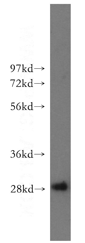 human liver tissue were subjected to SDS PAGE followed by western blot with Catalog No:111293(Hpn antibody) at dilution of 1:400