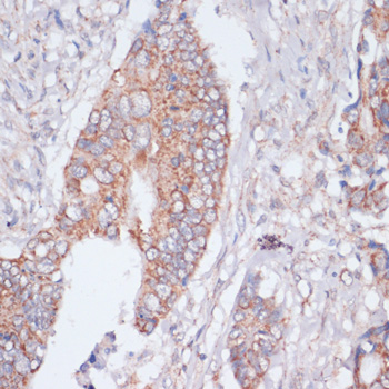 Immunohistochemistry - MBTPS1 Polyclonal Antibody 