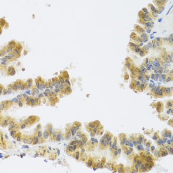 Immunohistochemistry - NMU Polyclonal Antibody 