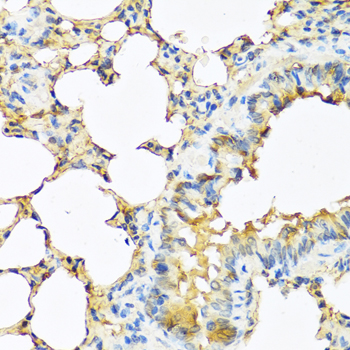 Immunohistochemistry - TSHB Polyclonal Antibody 