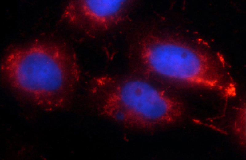 Immunofluorescent analysis of A431 cells using Catalog No:114929(RRP7A Antibody) at dilution of 1:25 and Rhodamine-Goat anti-Rabbit IgG
