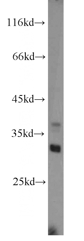 human liver tissue were subjected to SDS PAGE followed by western blot with Catalog No:112039(KHK antibody) at dilution of 1:1200